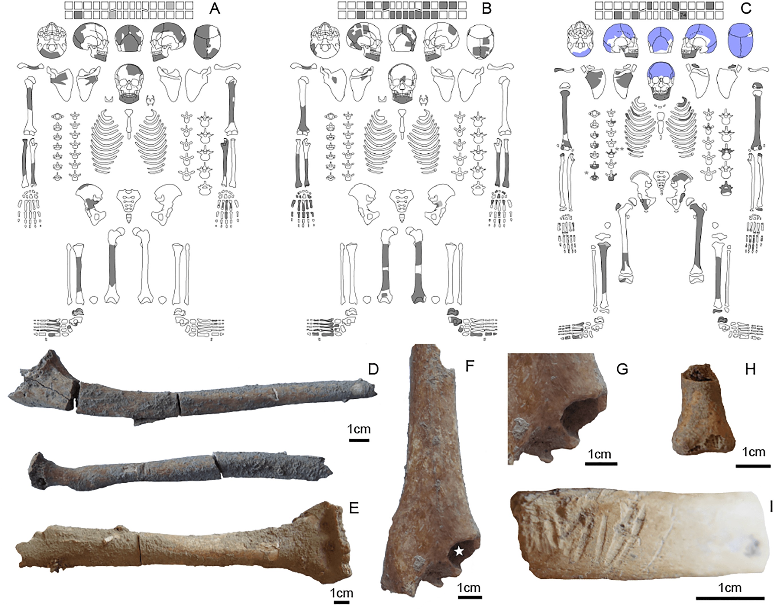 Three skeletons from the group burial found at Göbekli Tepe. Three skeletons from the group burial found at Göbekli Tepe.